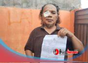 Wartawan Dipukuli dan Diancam Pembunuhan di Takalar Usai Liput Dugaan KDRT